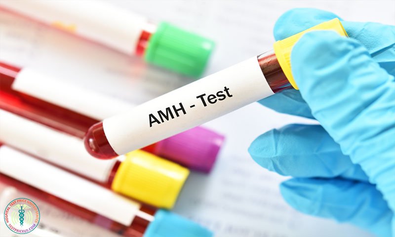 AMH Test Price