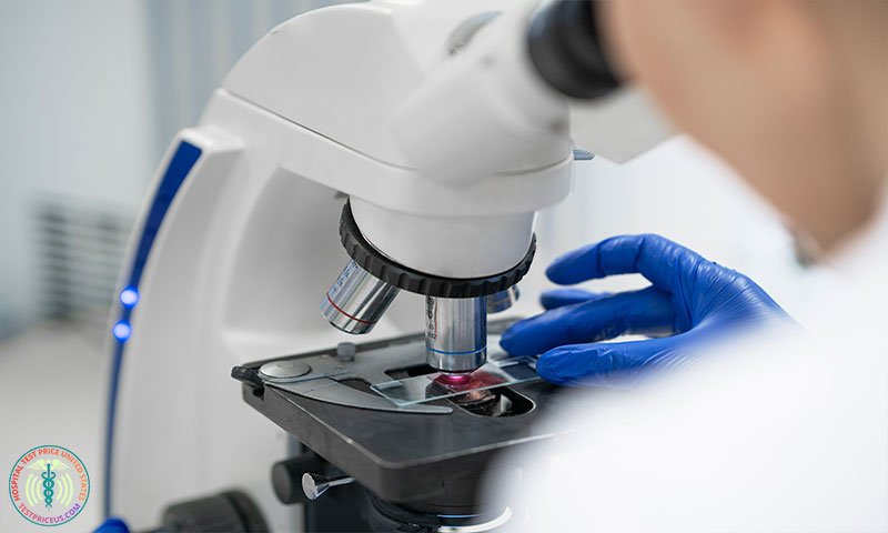 CBC Blood Test Price