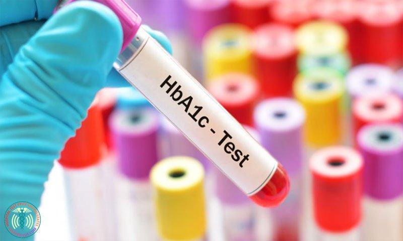 HBA1C Test Price